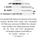 Image for Anti-phospho Sam68, Ser113/117, Polyclonal Antibody