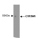 Western blot staining of human liver microsomes using anti-Cytochrome P450 2W1 [V32-P5E5].