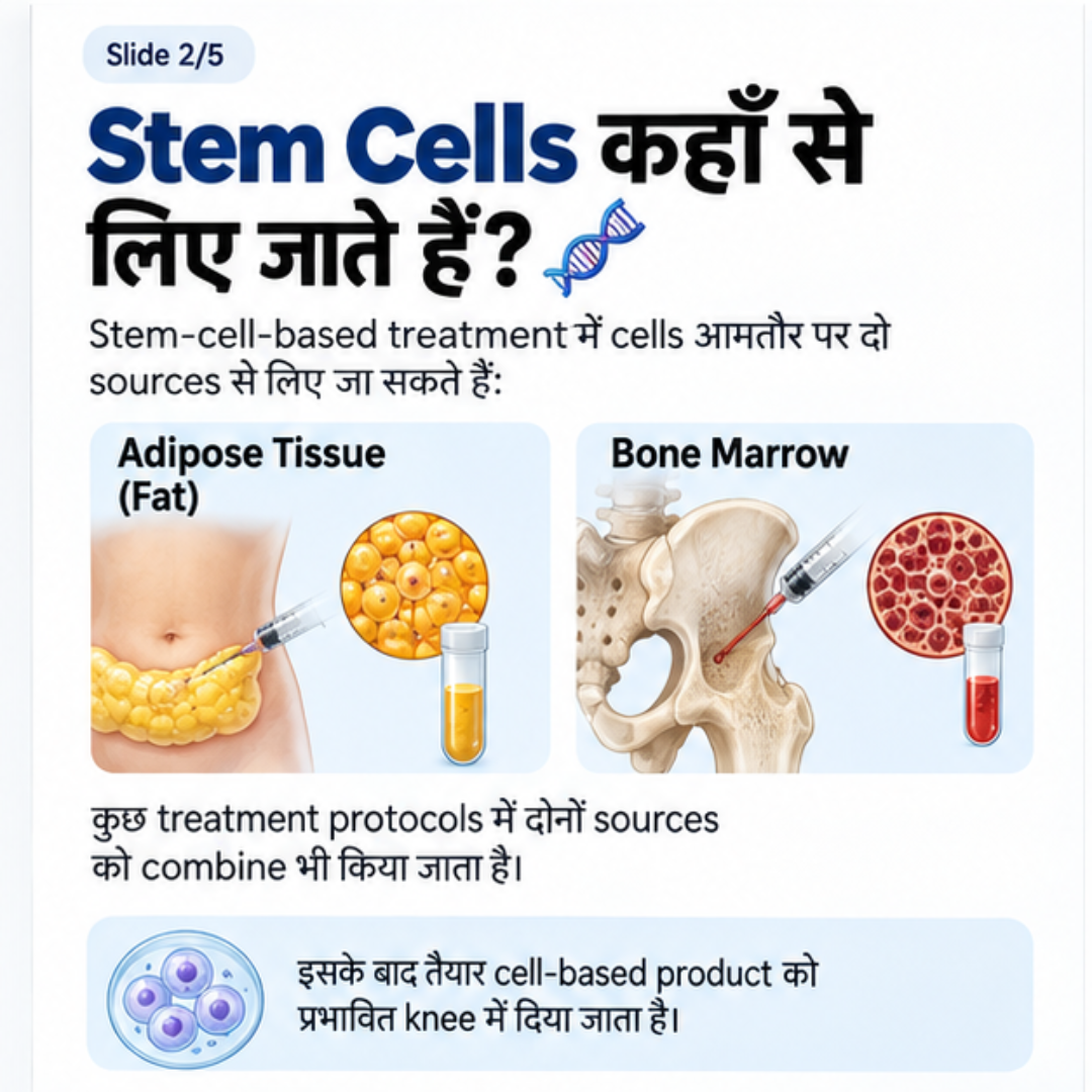 Stem cell sources: Adipose tissue and bone marrow