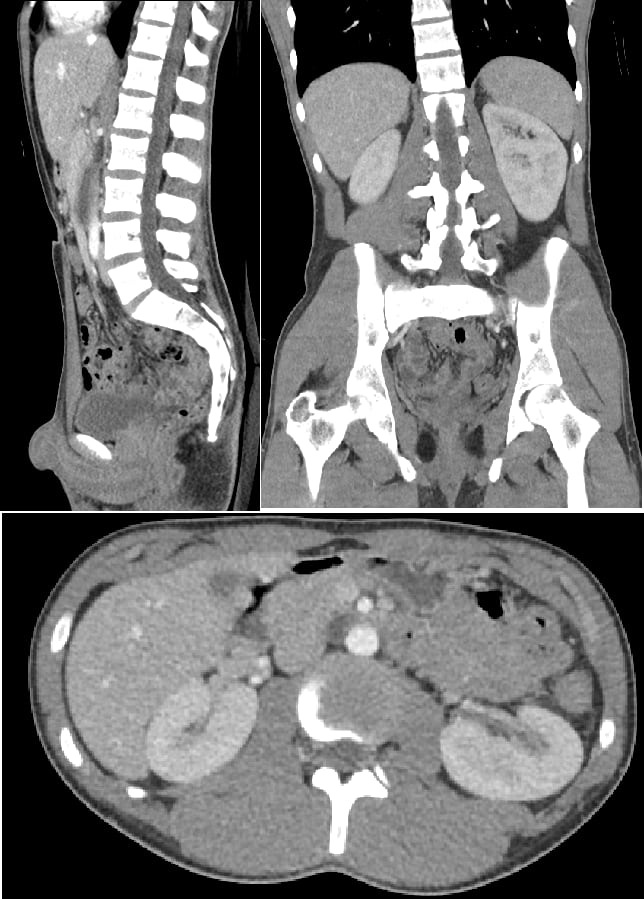 An Example of Detailed Abdomen CT Scan