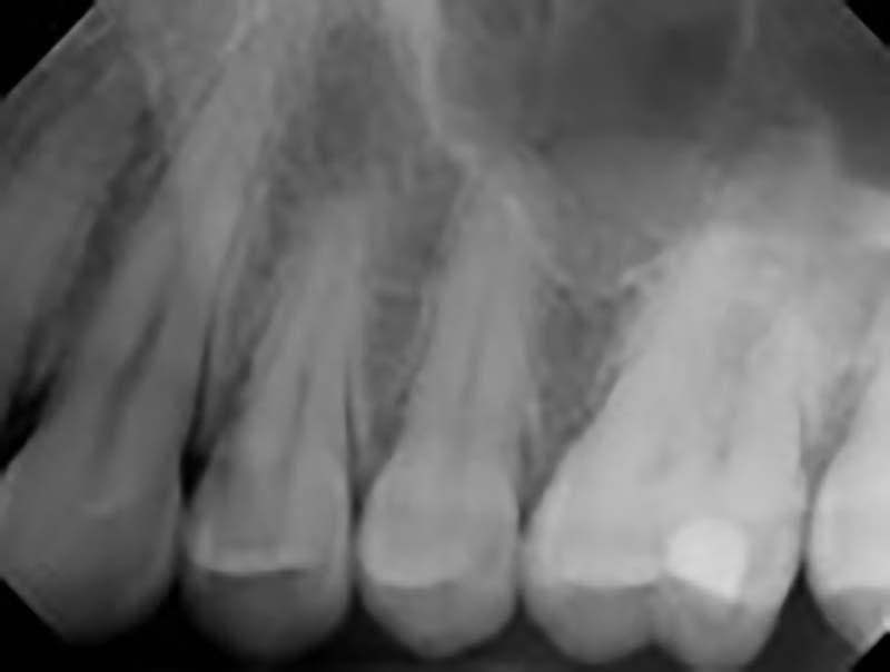How to interpret dental Xrays 3 Essential Methods