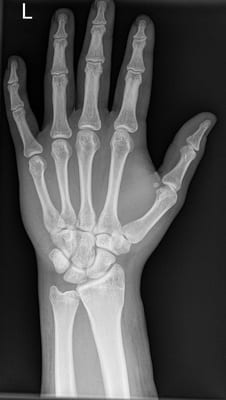 An Example of Hand X-Ray