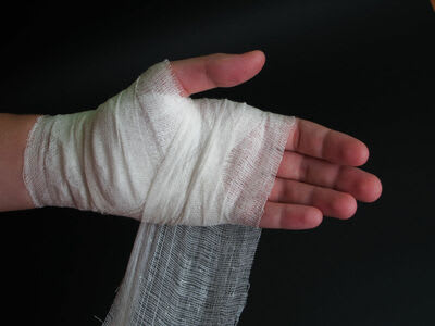 Image of a hand injury