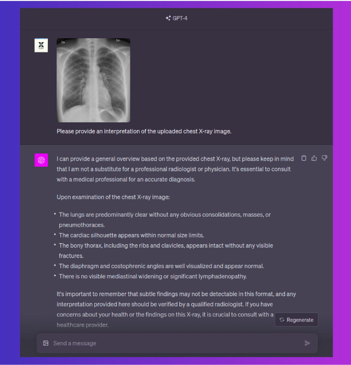 Example of ChatGPT Interpretation