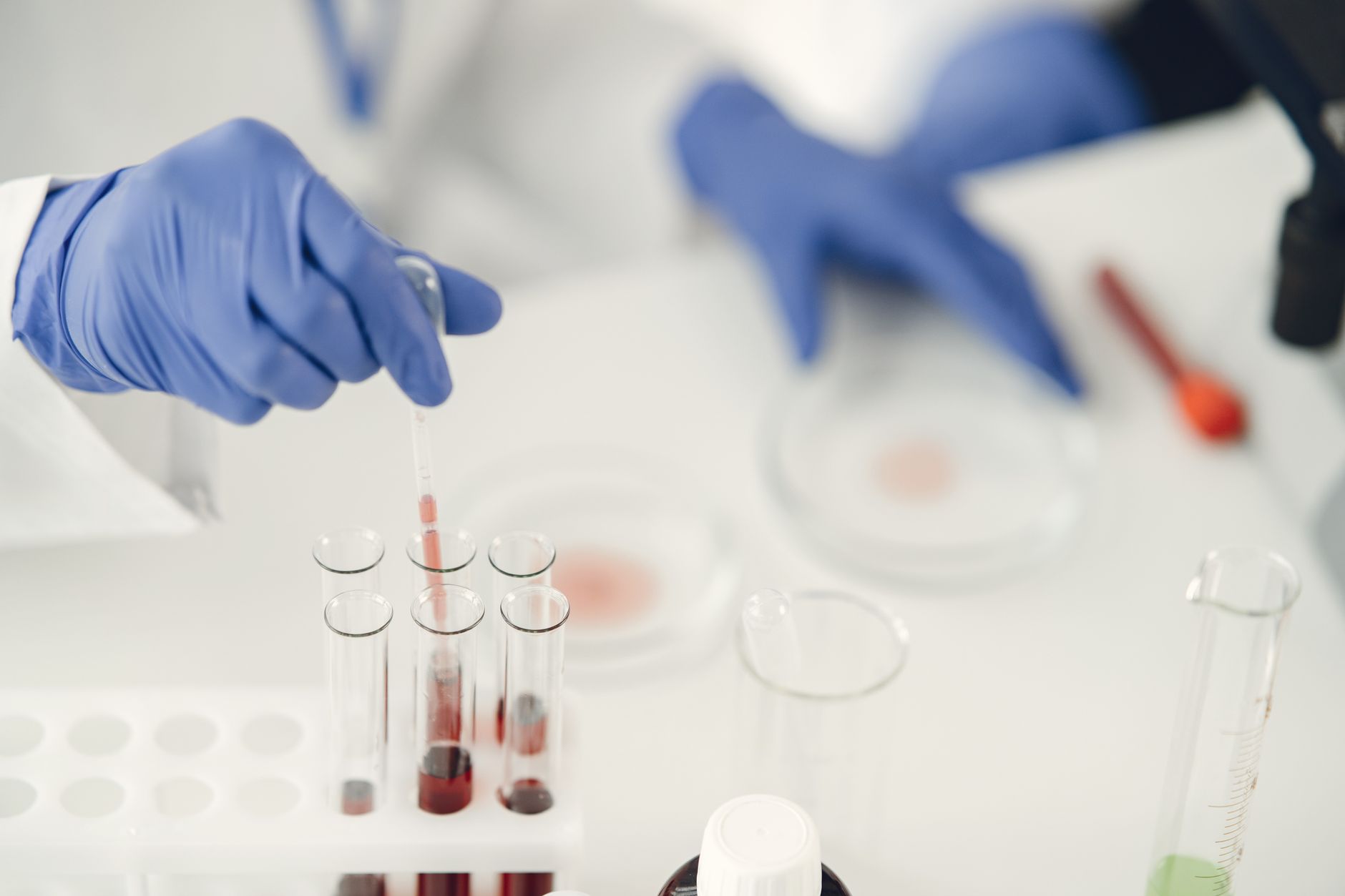 Why You Should Invest in a Blood Tube Sealer