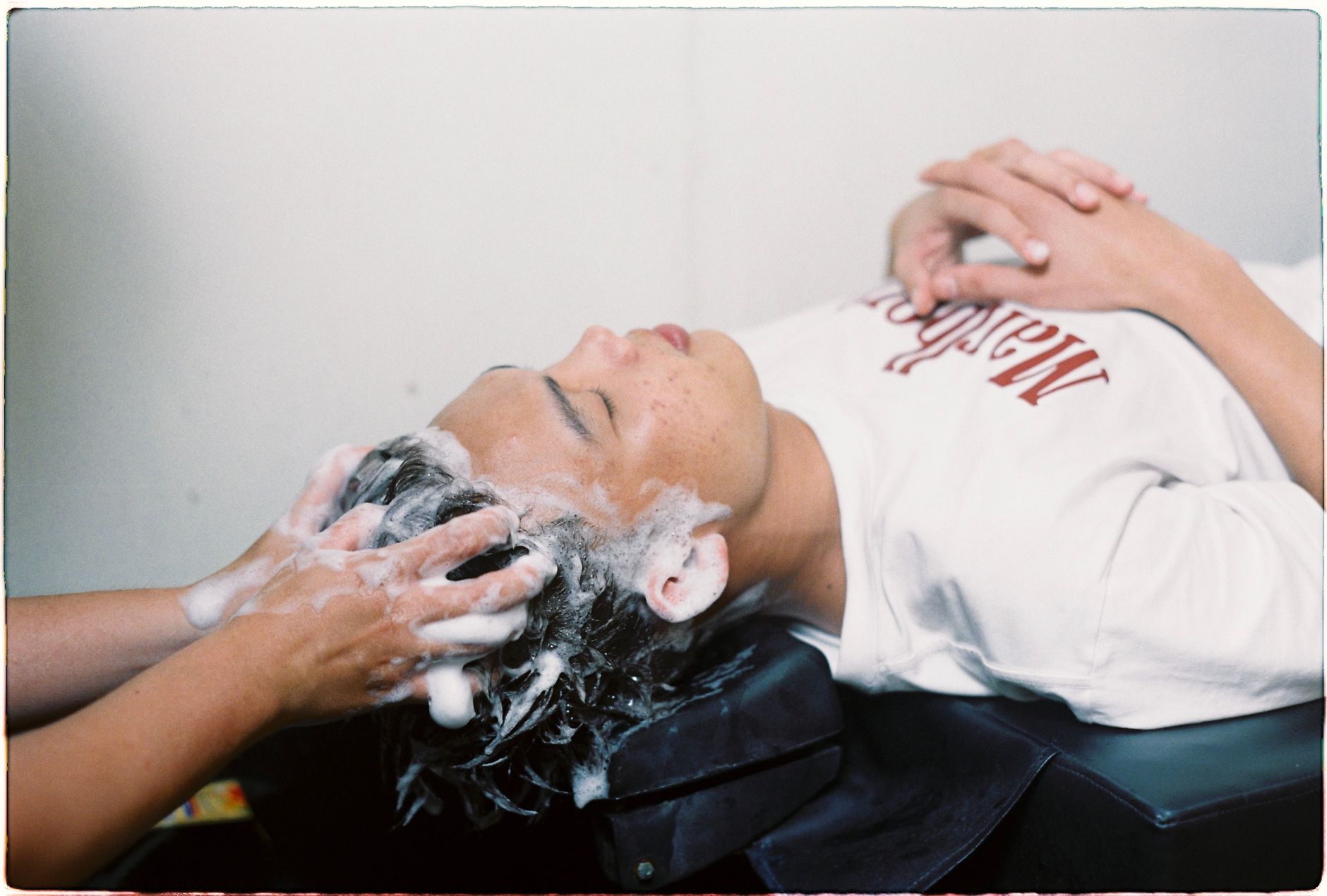 How to care for your scalp after a hair transplant