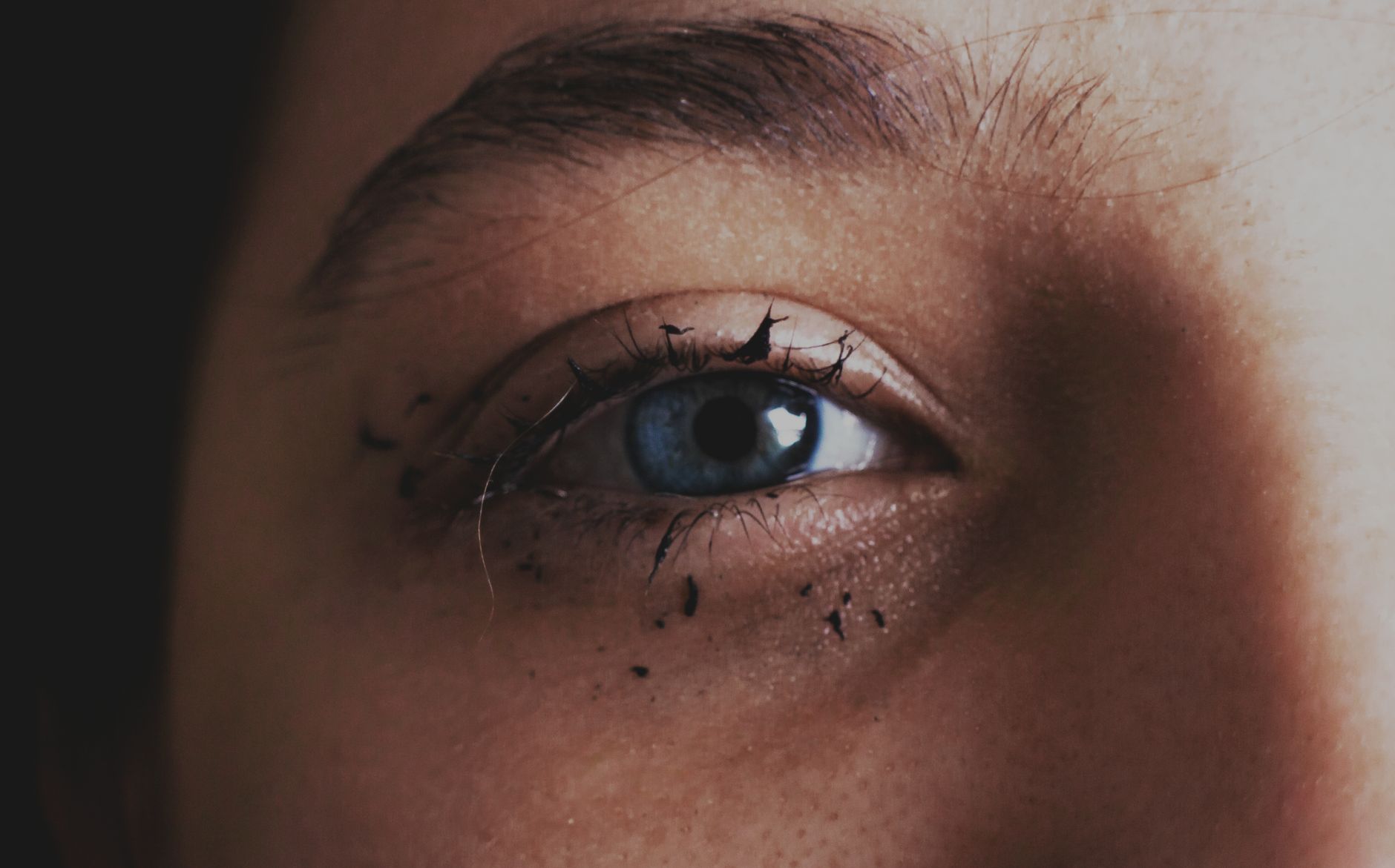 Non-Surgical Upper Eyelid Lifting: What You Need to Know