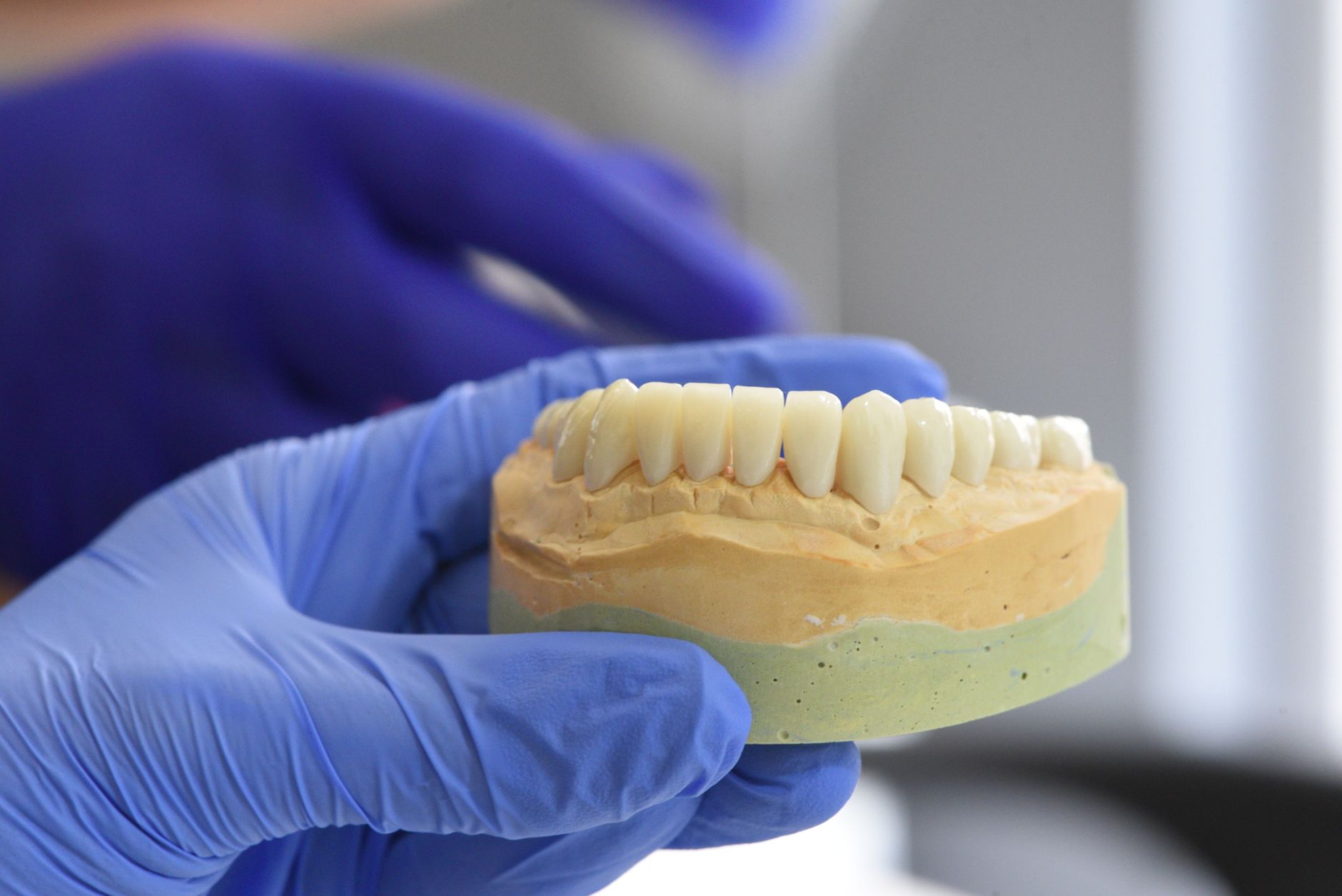Digital Impressions: Say Goodbye to Uncomfortable Putty Impressions