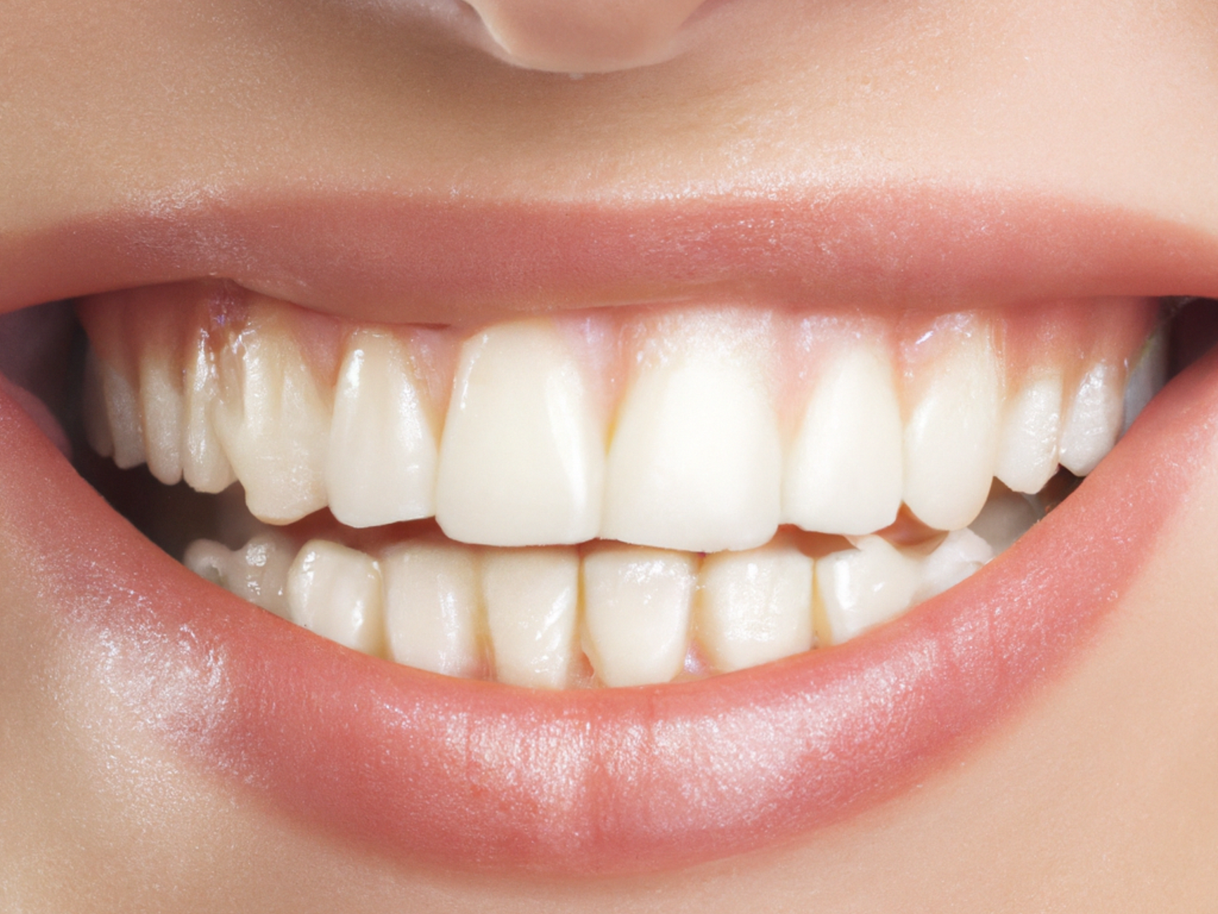 Revitalize Your Pearly Whites and Flash an Eccentric Smile with Dental Fillings