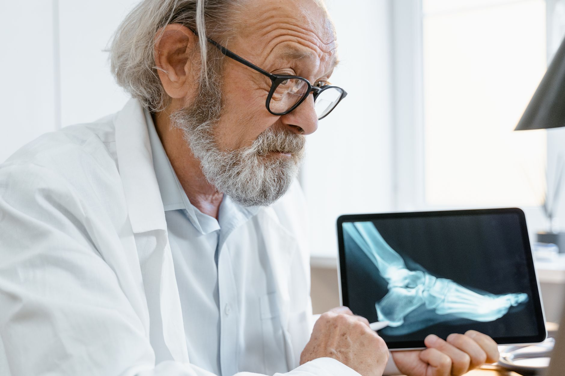 Understanding Bone Fractures