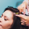 WHY YOU SHOULD OPT FOR PRP FOR HAIR?