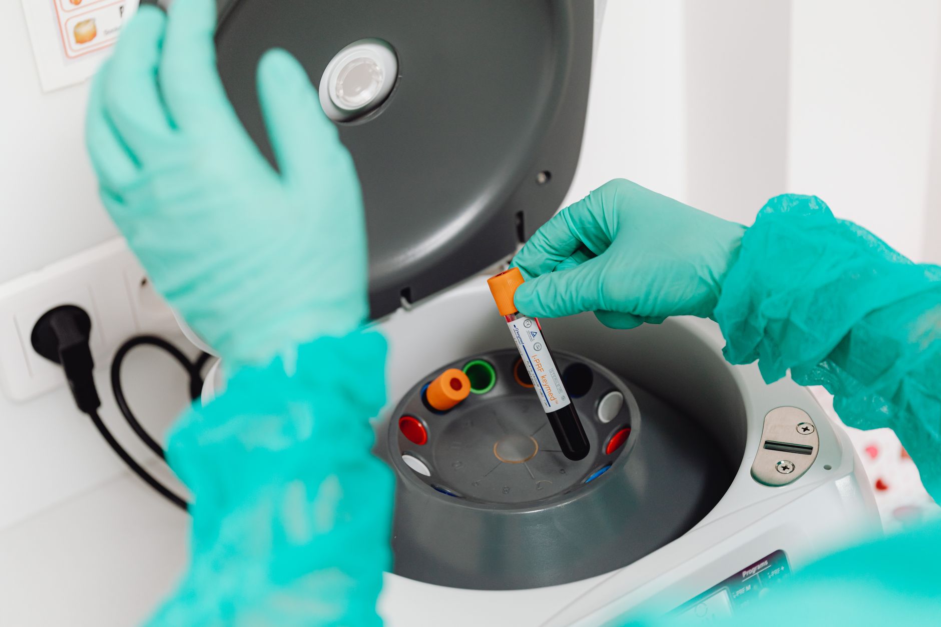 Uses of a Cytology Centrifuge