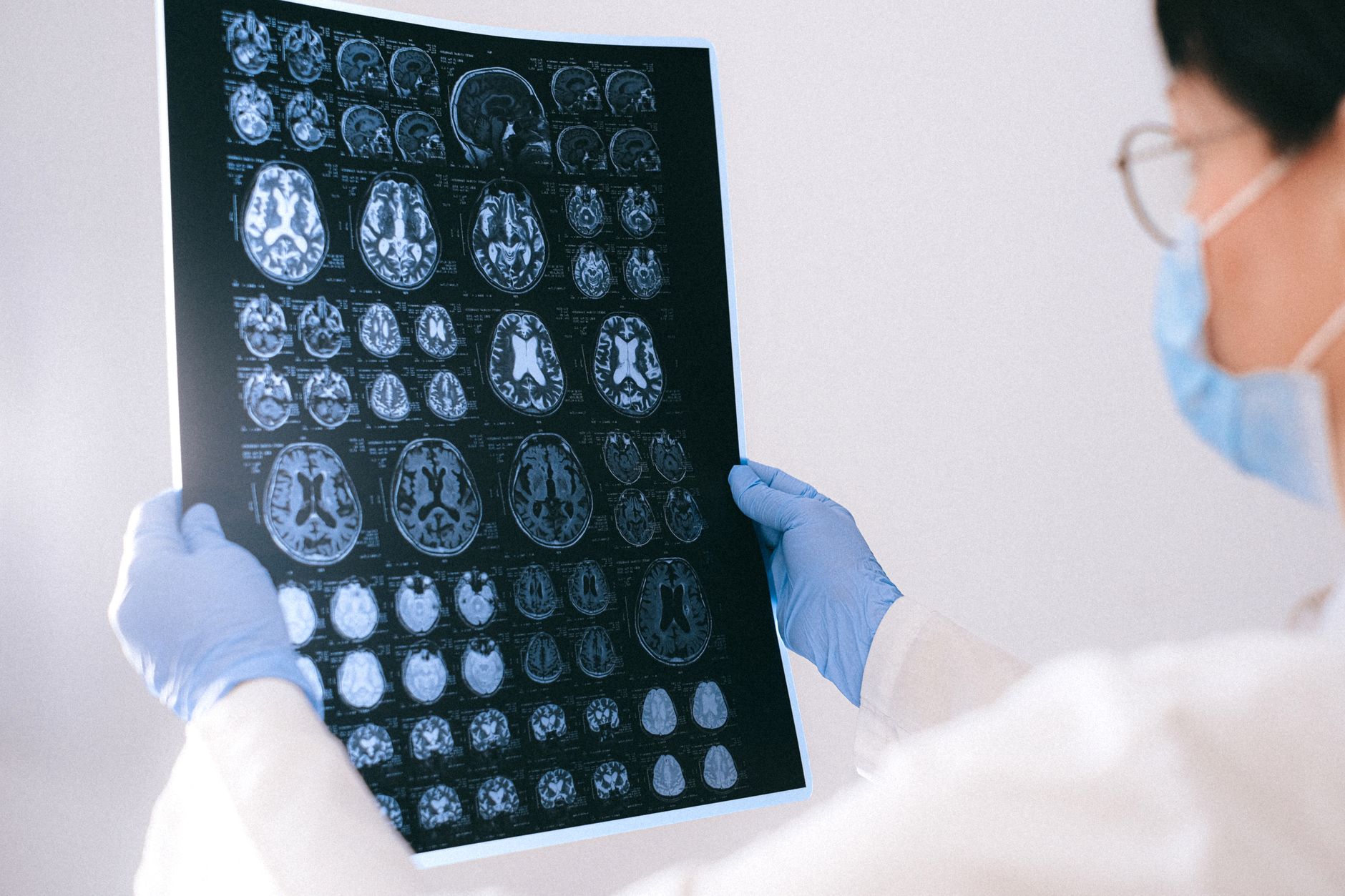 Biogen moves forward with Alzheimer’s drug trial