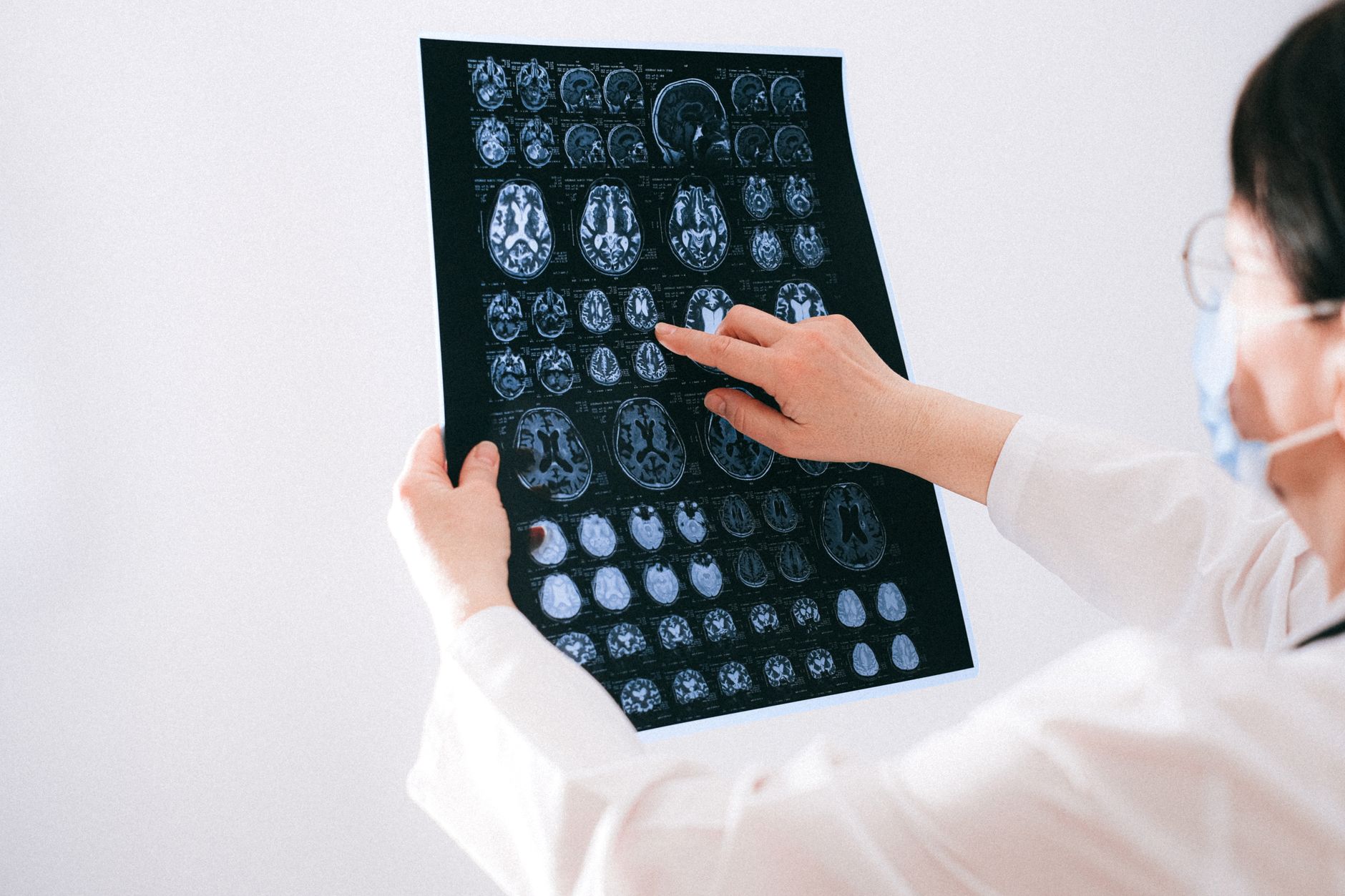 Molecule may reverse brain’s Alzheimer’s defenses