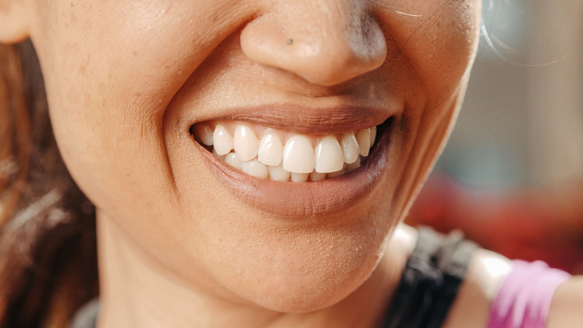 Healthy teeth—healthy soul?