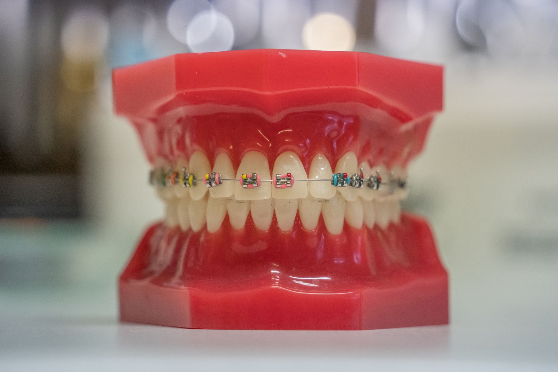 The Adult Orthodontics Facts that Most People Have Been Missing Over the Years