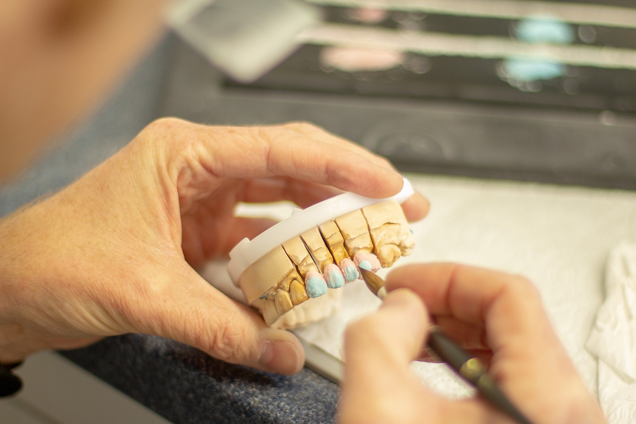 What You Need to Know Before Having Dental Implants