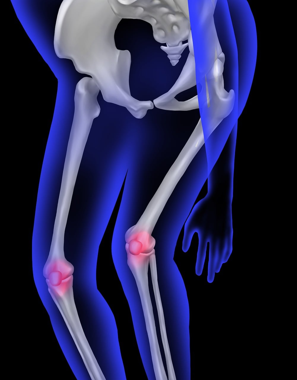 Demystifying Myths about Orthopedic Surgery