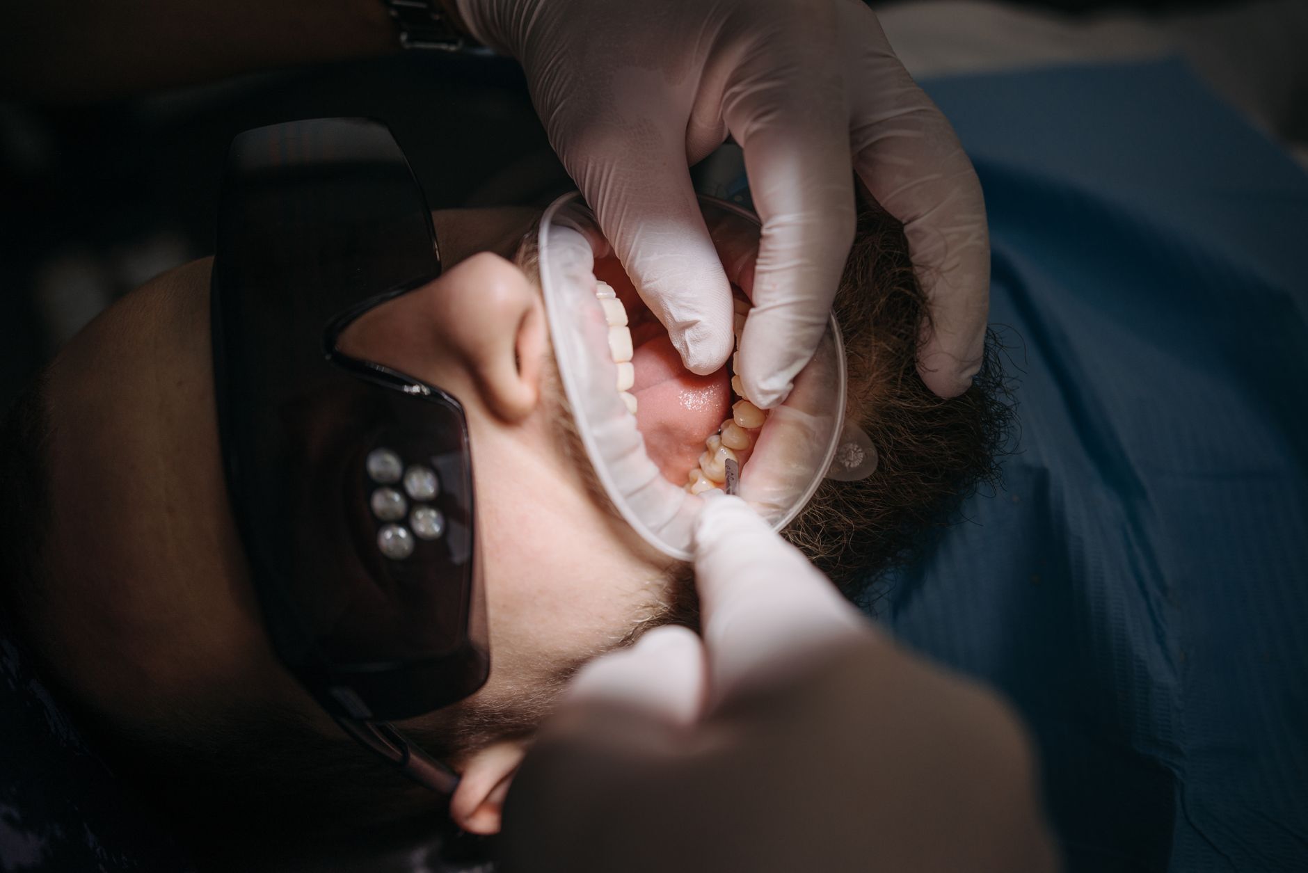 5 Common Cosmetic Dentistry Misconceptions