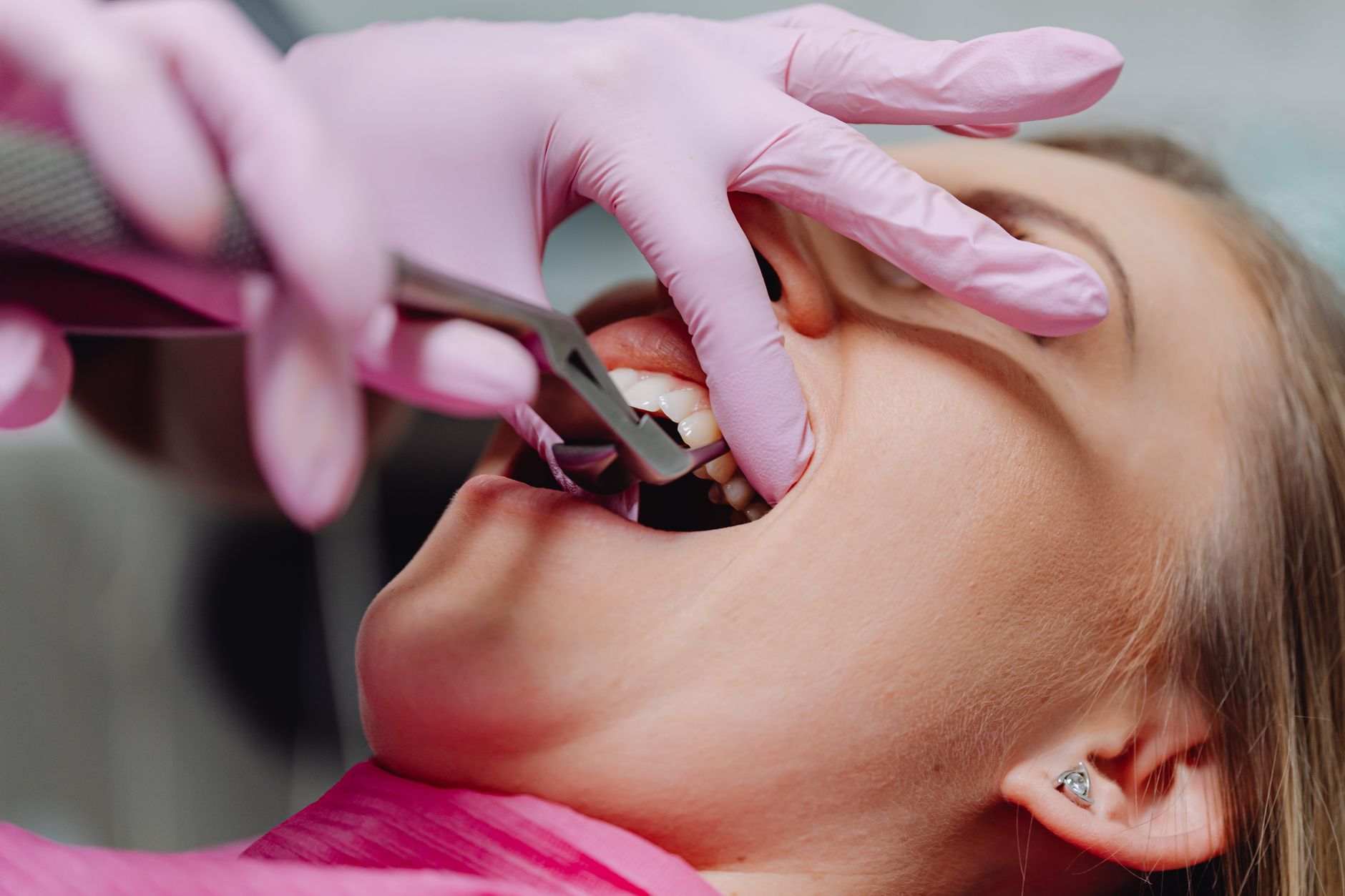 Oral Surgeries: 6 Types that A Dentist in Toledo Performs!