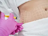 مزوتراپی لاغری