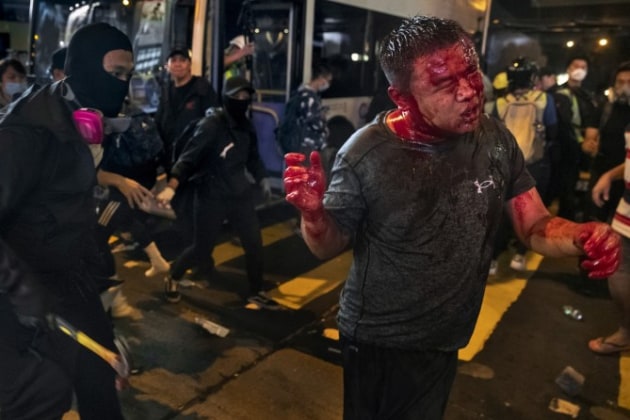 Winner - Breaking News Photography. © Thomas Peter (Photography Staff of Reuters). A masked anti-government protester, wielding a hammer, attacks a man who bystanders suspected of being a pro-Beijing activist from mainland China, during a protest in the Mong Kok area in Hong Kong, China November 11, 2019. The bloodied man, who suffered major facial and head trauma, was reported to have survived his injuries by local media. (Thomas Peter/December 31, 2019)