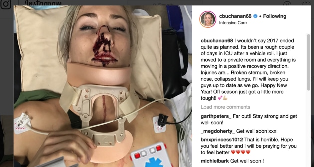 Caroline just posted her bruised chest on twitter after getting