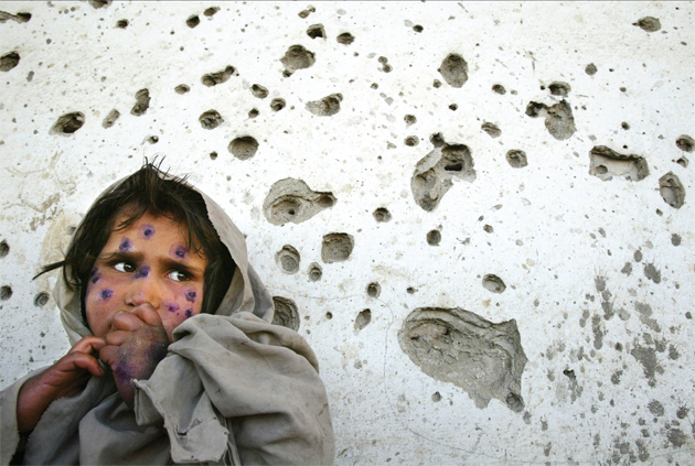 Mohboba, age 7, stands against a bullet-ridden wall waiting to be seen at a health clinic in Kabul. She has
the infection Leishmaniasis, that plagues a number of
poverty-stricken children in Afghanistan. March, 2002. © Paula Bronstein