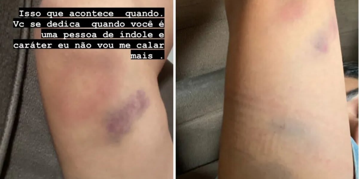 Cantora agredida