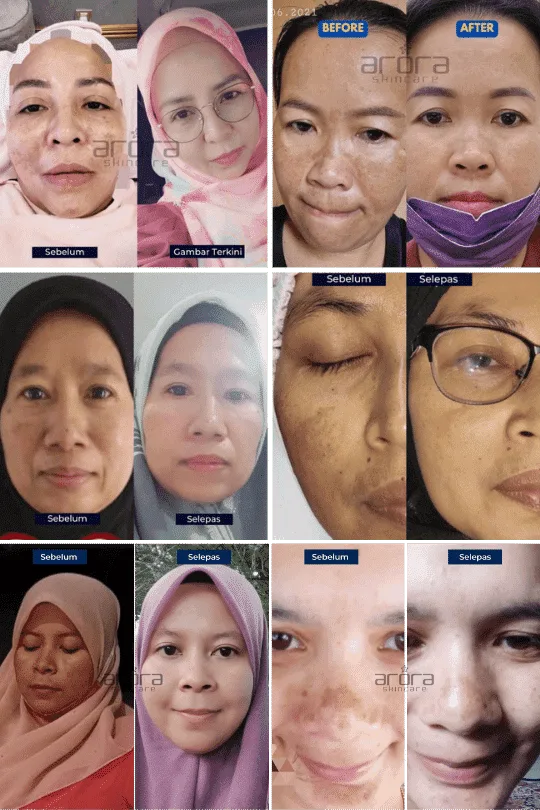 Transformasi pengguna Arora 1