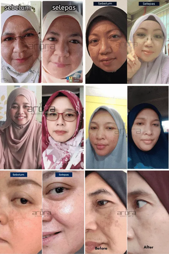 Transformasi pengguna Arora 2