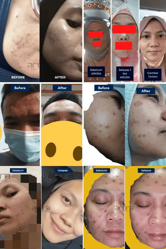 Transformasi pengguna Arora 3