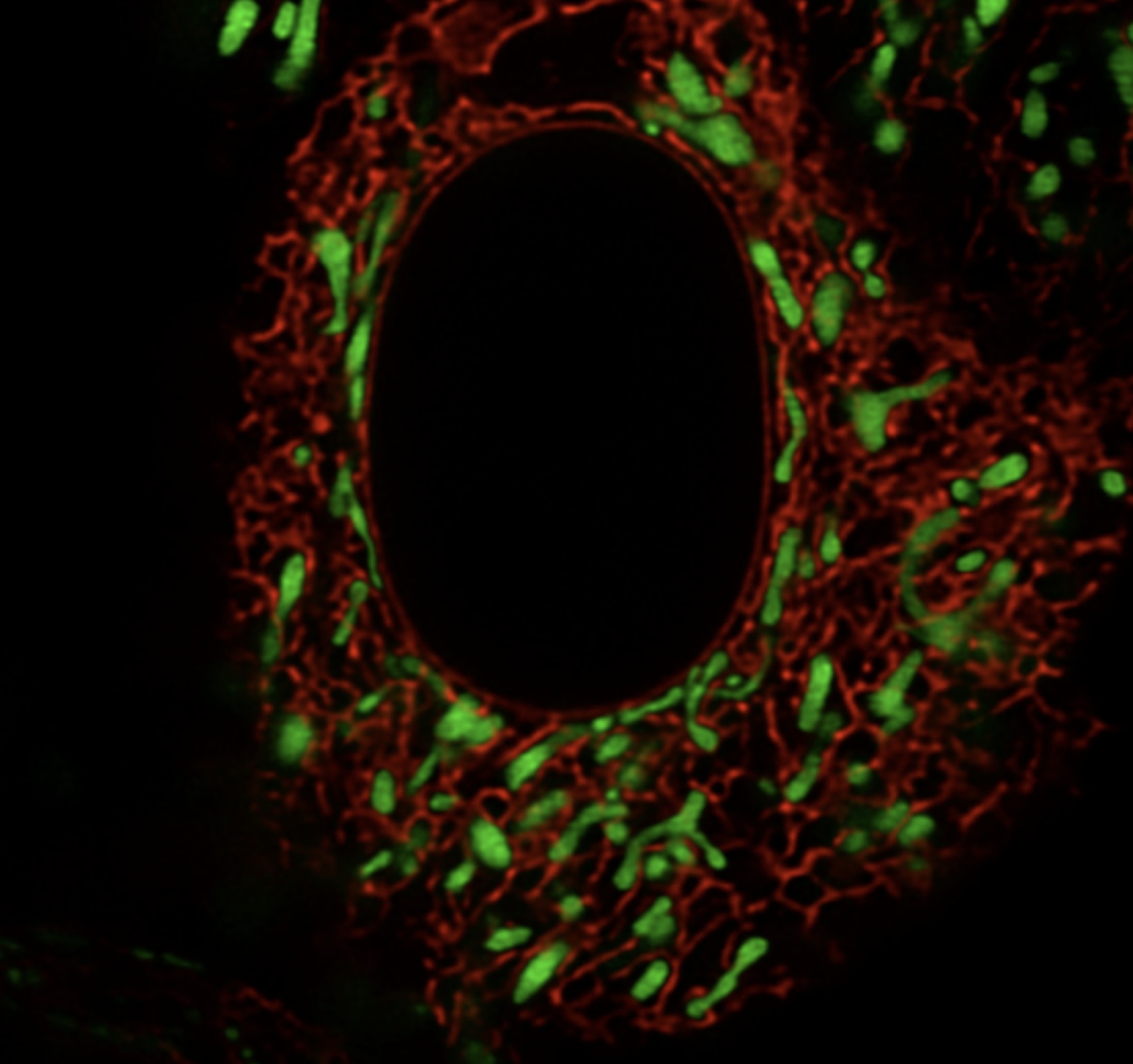 Investigating autosomal dominant polycystic kidney disease