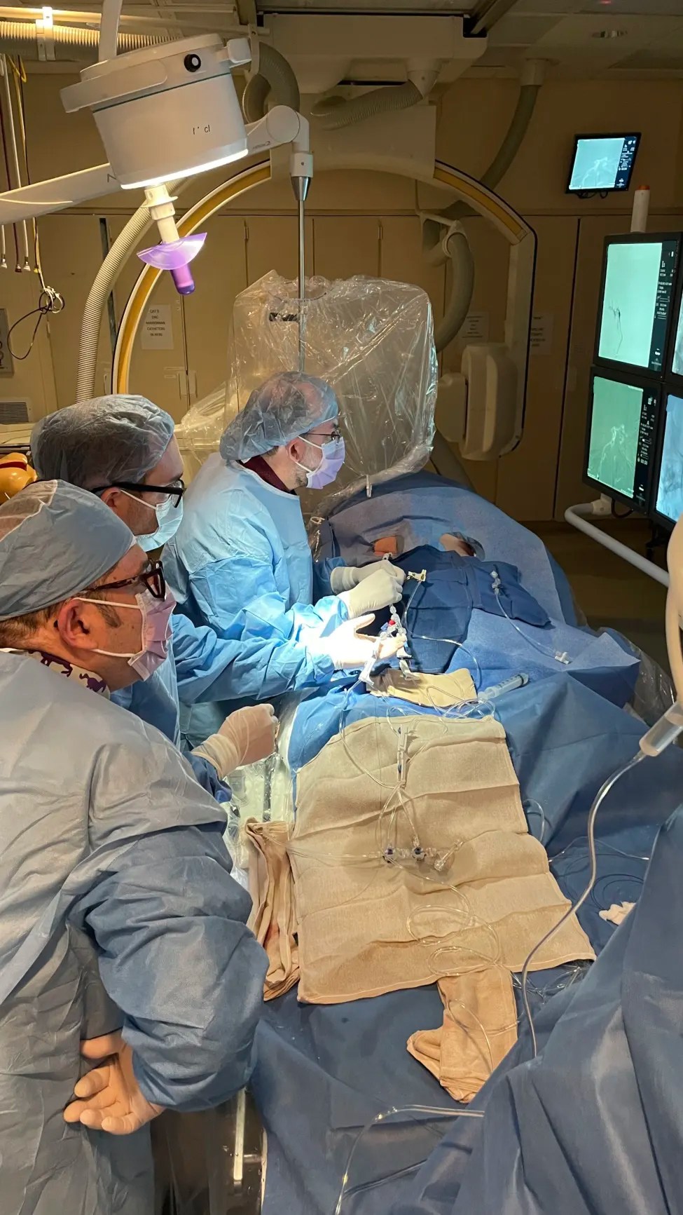 Yale Neurosurgeons Implant First Endovascular Device for Hydrocephalus