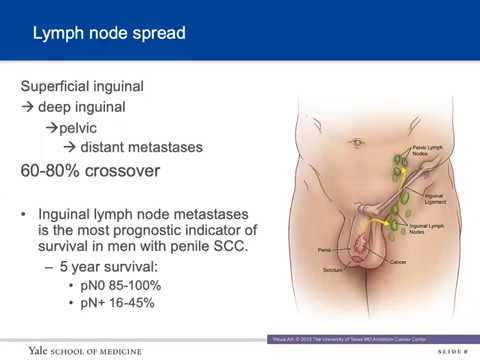 male inguinal lymph nodes