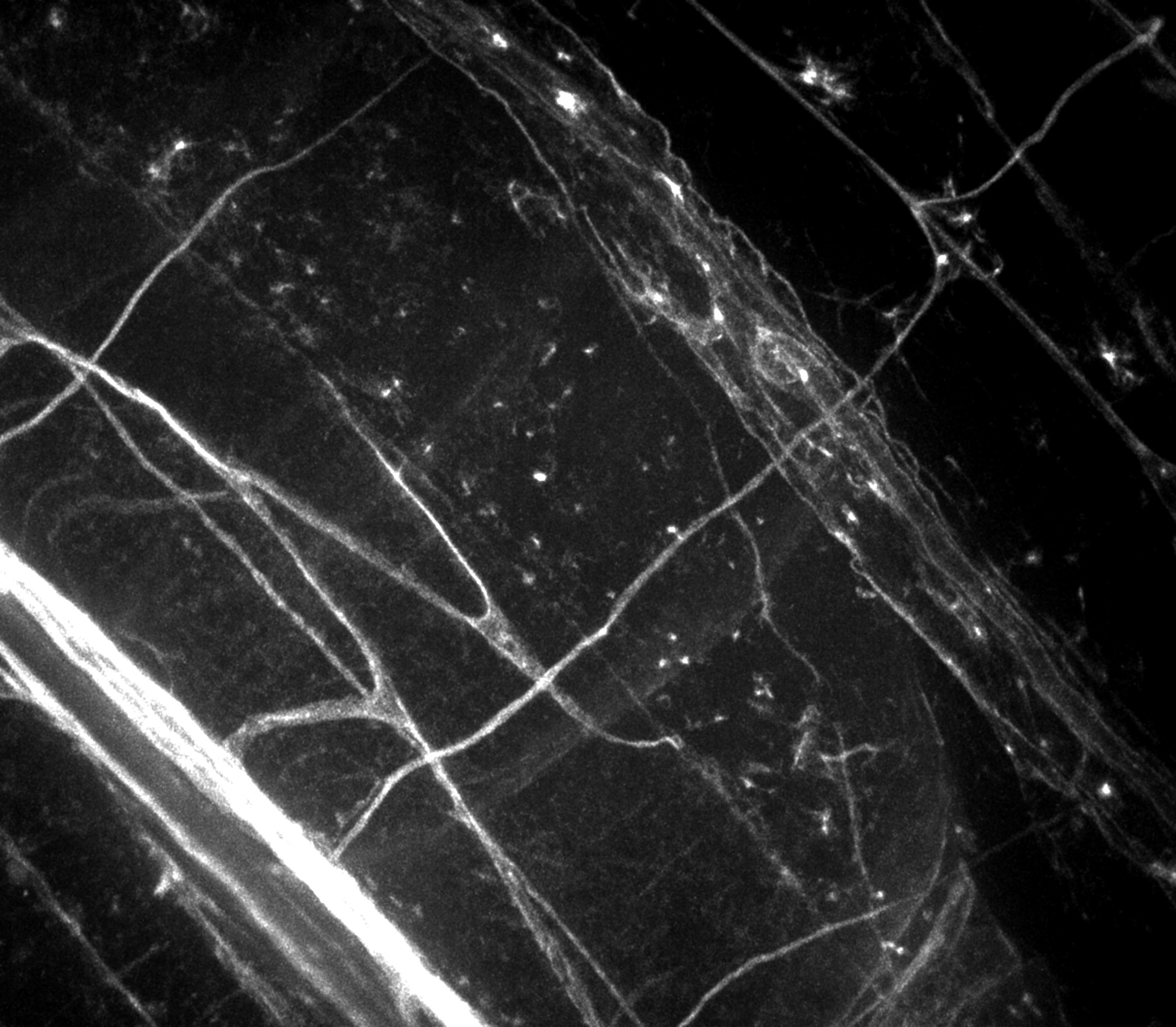 Yale researchers visualize “ultra-slow” axonal transport in a living ...