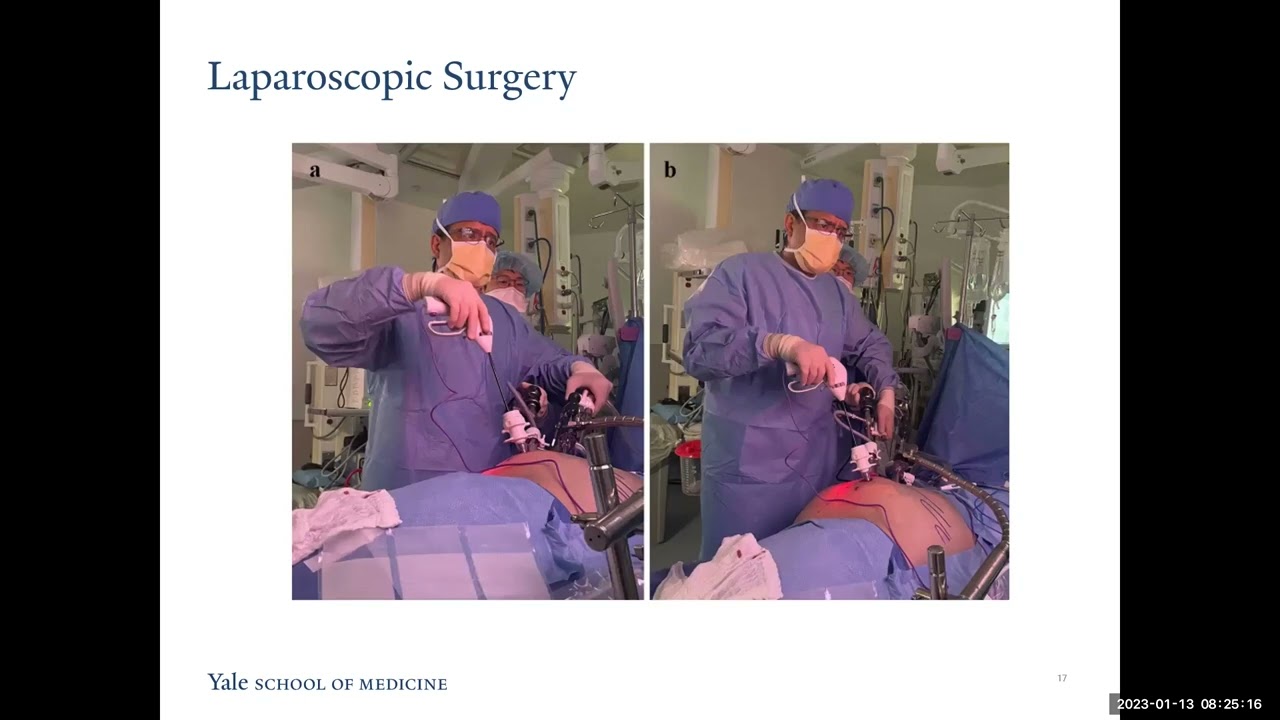 Surgical Ergonomics for the Urologist