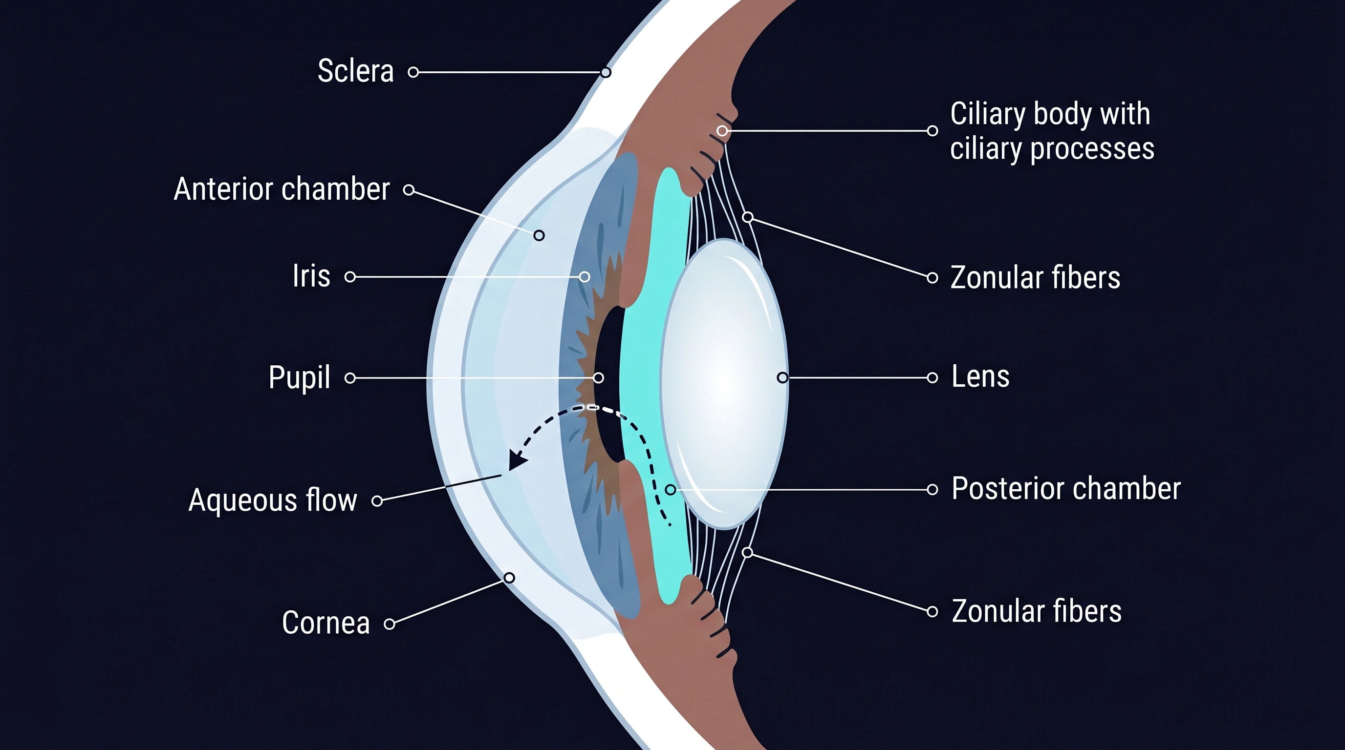 Labelled cross-section of the anterior eye showing the posterior chamber behind the iris, with the ciliary body, zonular fibers, lens, and aqueous flow through the pupil.