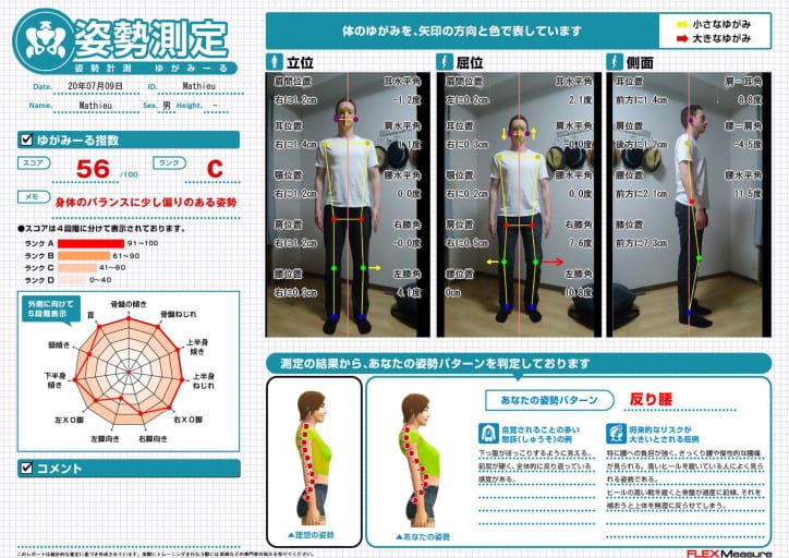 姿勢分析 ゆがみーる LITE-