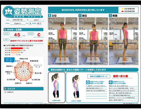 AI姿勢分析システム ゆがみーるクラウド | ゆがみーるクラウドPROでAI