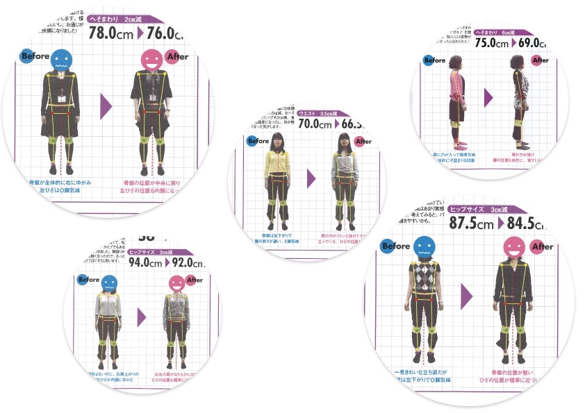 ゆがみーる雑誌掲載記事02 日経ヘルス ゆがみーるレポート