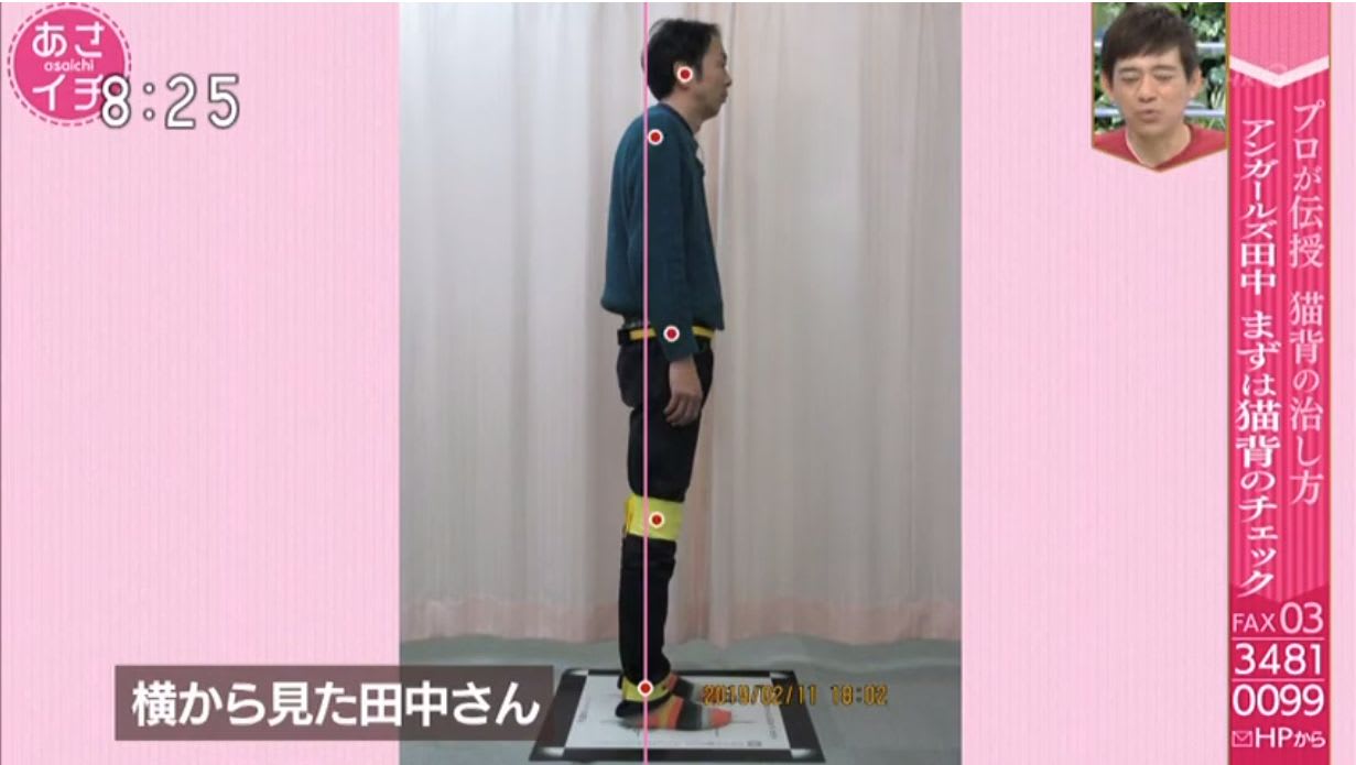 アンガールズ田中さんゆがみーるレポート矢状面