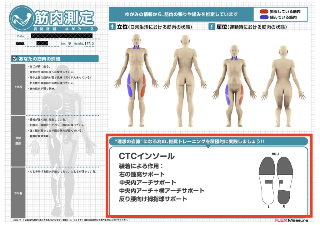 CTCインソールレポート2(木村社長)
