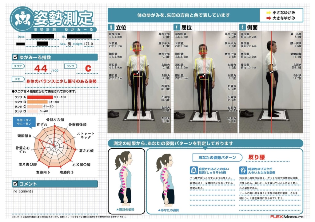 CTCインソールレポート1(木村社長)