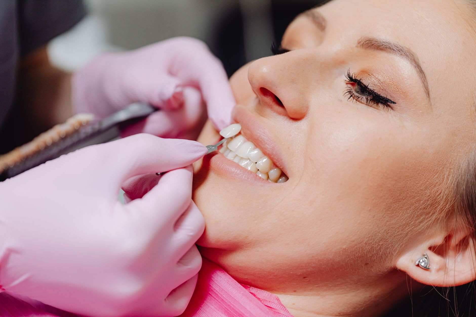 4 natural ways to whiten teeth, effective and without side effects