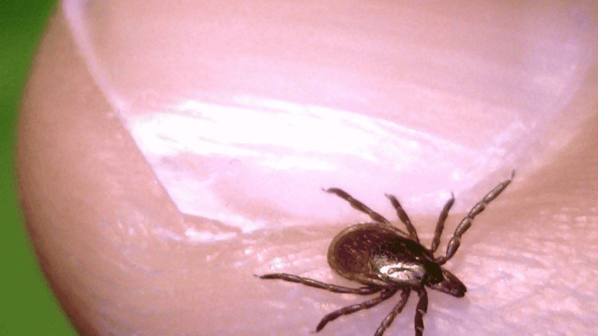 Lyme Disease Patients May Benefit from Nutrients Lyme Disease Patients May Benefit from Nutrients - lyme disease