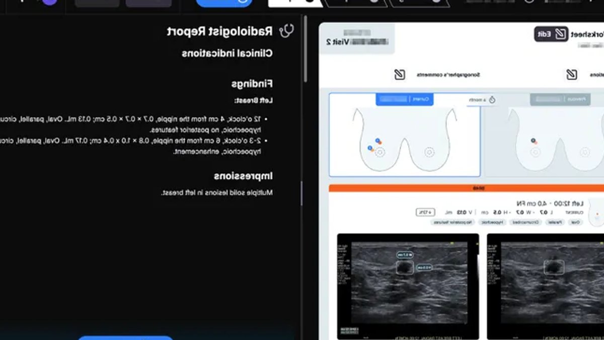 DeepHealth's AI Ultrasound Tool Wins FDA Approval DeepHealth's AI Ultrasound Tool Wins FDA Approval - ai ultrasound