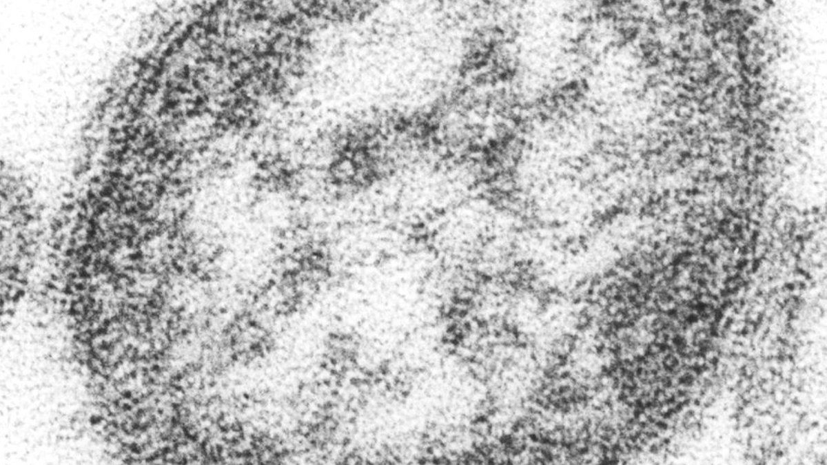 Measles Elimination Status Assessment Details Measles Elimination Status Assessment Details - measles elimination status