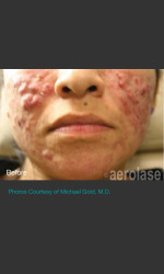  Physician - Prejuvenation before & after