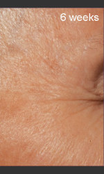 before_after/defenage-clinical-power-trio/16809 Physician- Prejuvenation Before & After